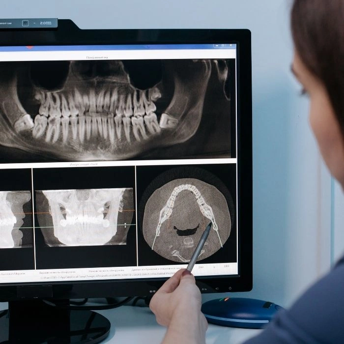 Diagram of digital X-rays in West Jordan, UT
